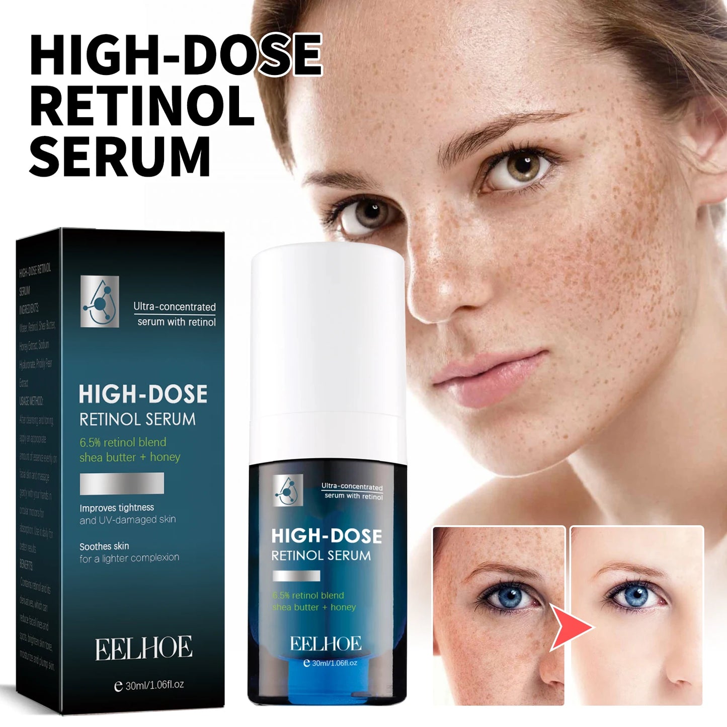 Hydrating Face Serum, Dark Spot Remover, Moisturizer