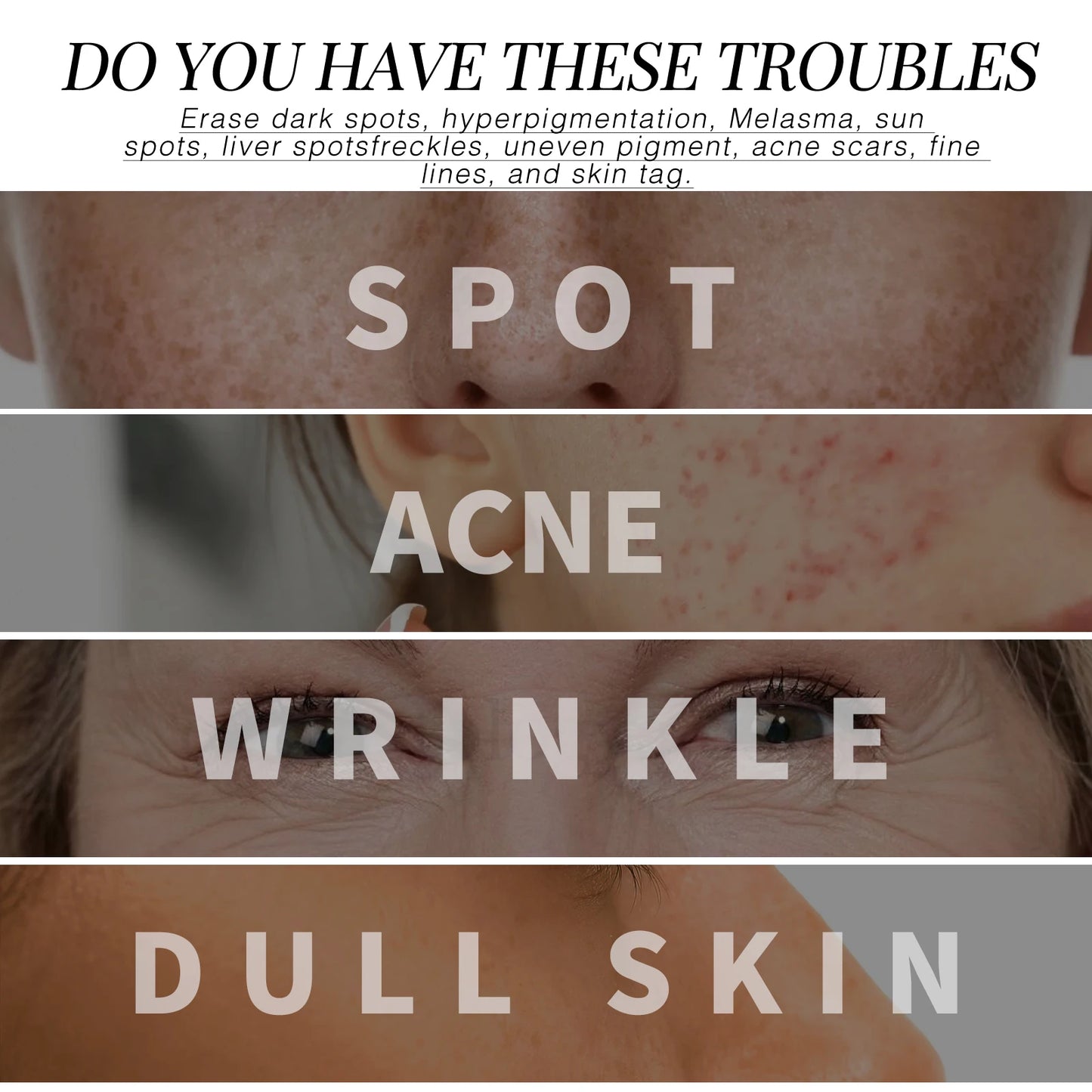 Hydrating Face Serum, Dark Spot Remover, Moisturizer