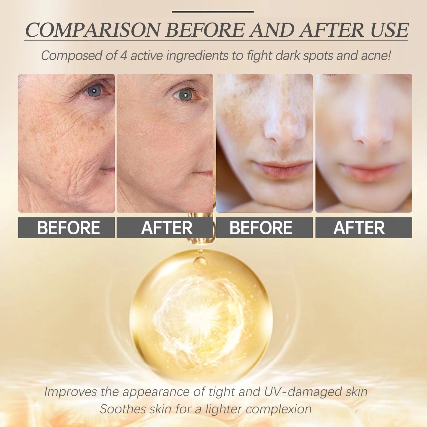 Hydrating Face Serum, Dark Spot Remover, Moisturizer