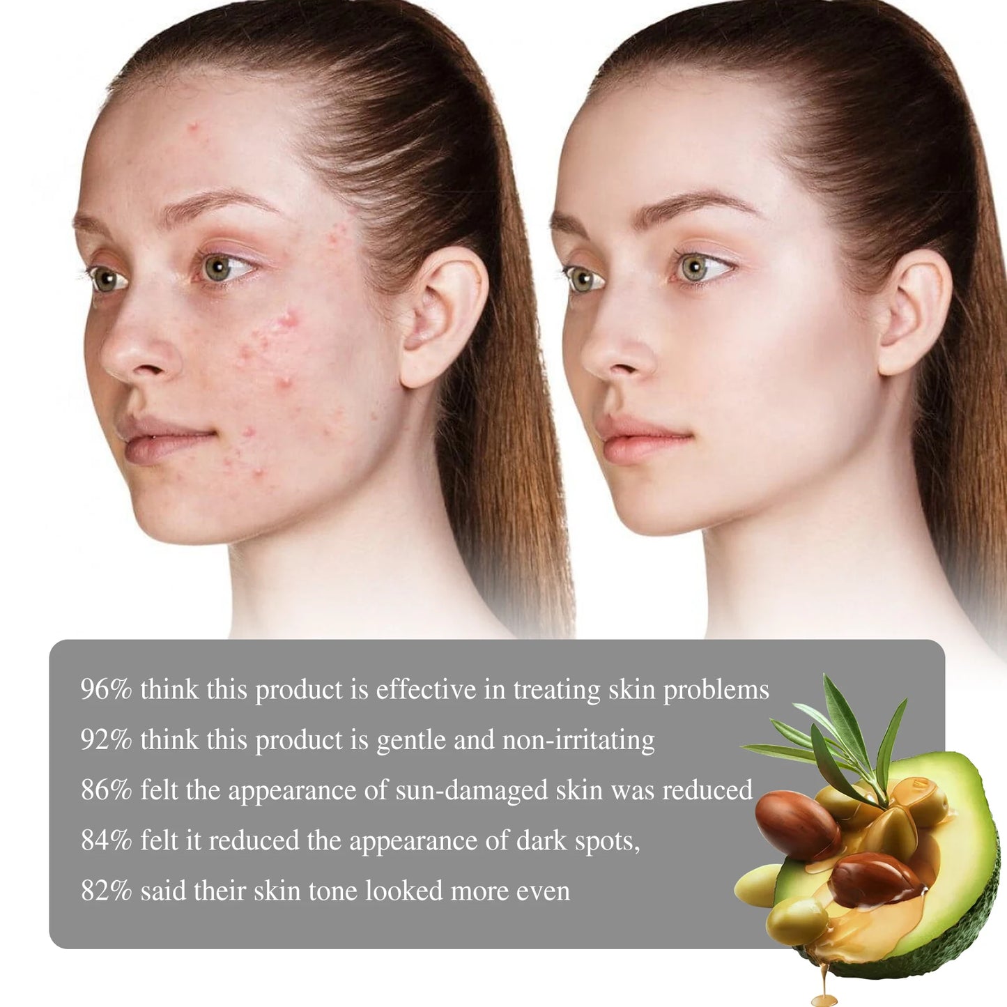 Hydrating Face Serum, Dark Spot Remover, Moisturizer