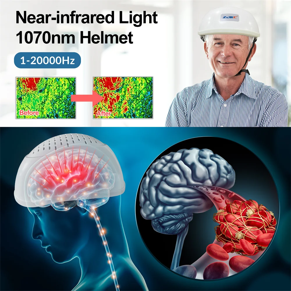 Infrared Light Helmet, 1070nm Dementia Therapy, for Stroke Victims, Alzheimer, Boost Brain Activities,  Enhance Cognition